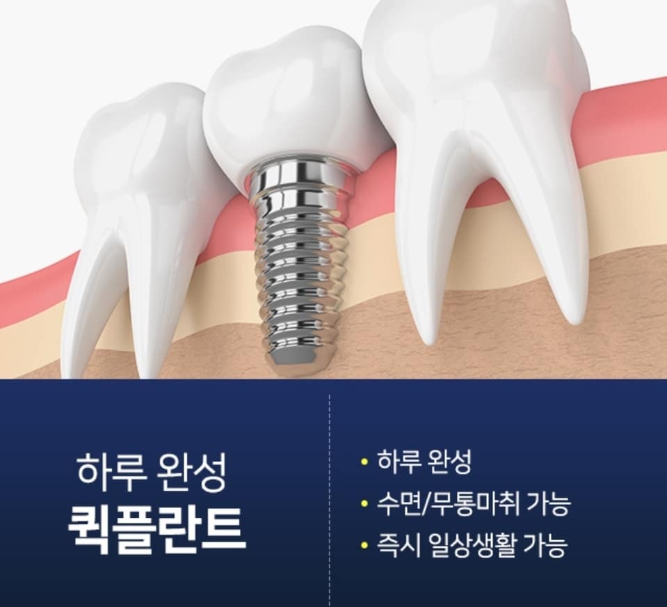 성남 임플란트 서울플러스치과 퀵플란트